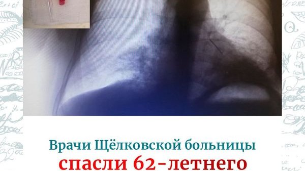 dh81p3trtftcvwmpaa63f3kn4gpu4dv6